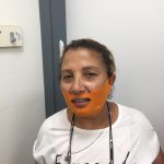 מסכה לטיפול בסנטר כפול ועיצוב קו צוואר